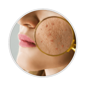 Pakiet badań zdrowa skóra