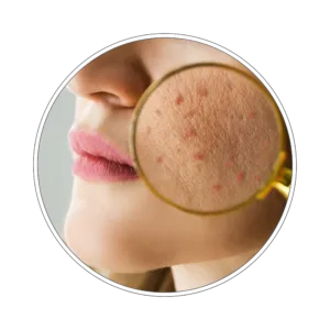 Pakiet badań zdrowa skóra