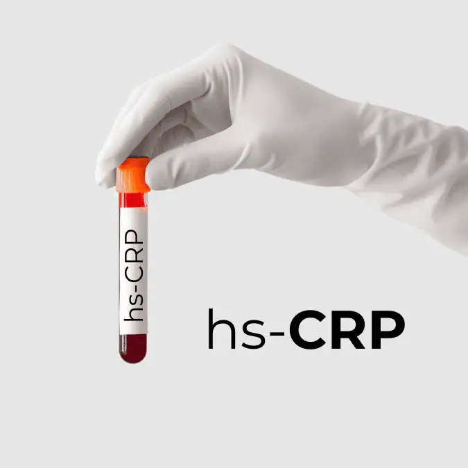 Badanie hs-CRP - test na marker stanu zapalnego w badaniach krwi.